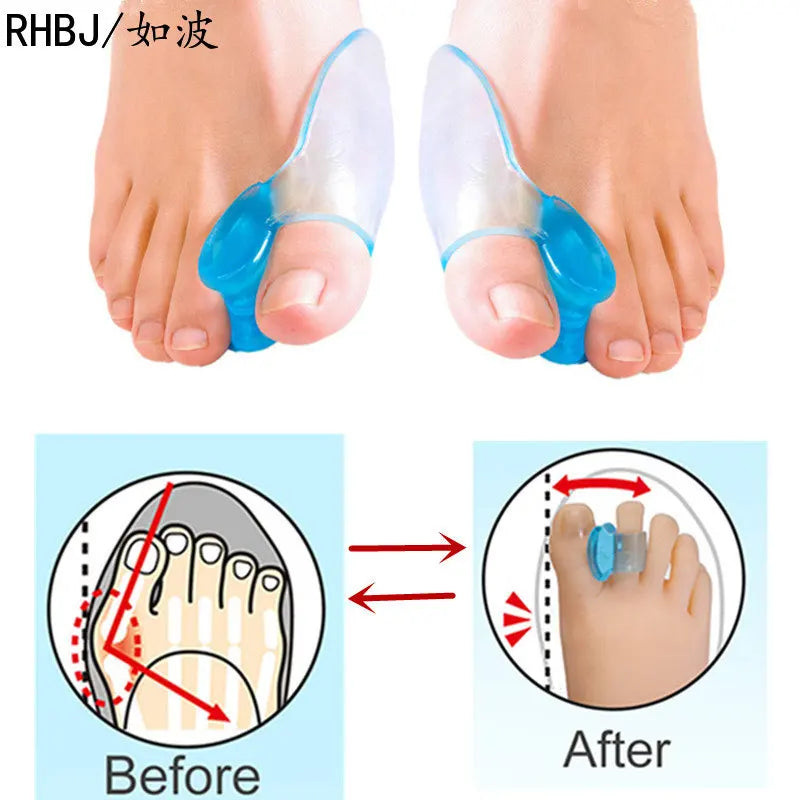 2Pcs Silicone Gel Thumb Corrector Bunion Foot Toe Hallux Valgus Protector Separator Finger Straightener Adjuster Foot Care Tool