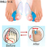 2Pcs Silicone Gel Thumb Corrector Bunion Foot Toe Hallux Valgus Protector Separator Finger Straightener Adjuster Foot Care Tool