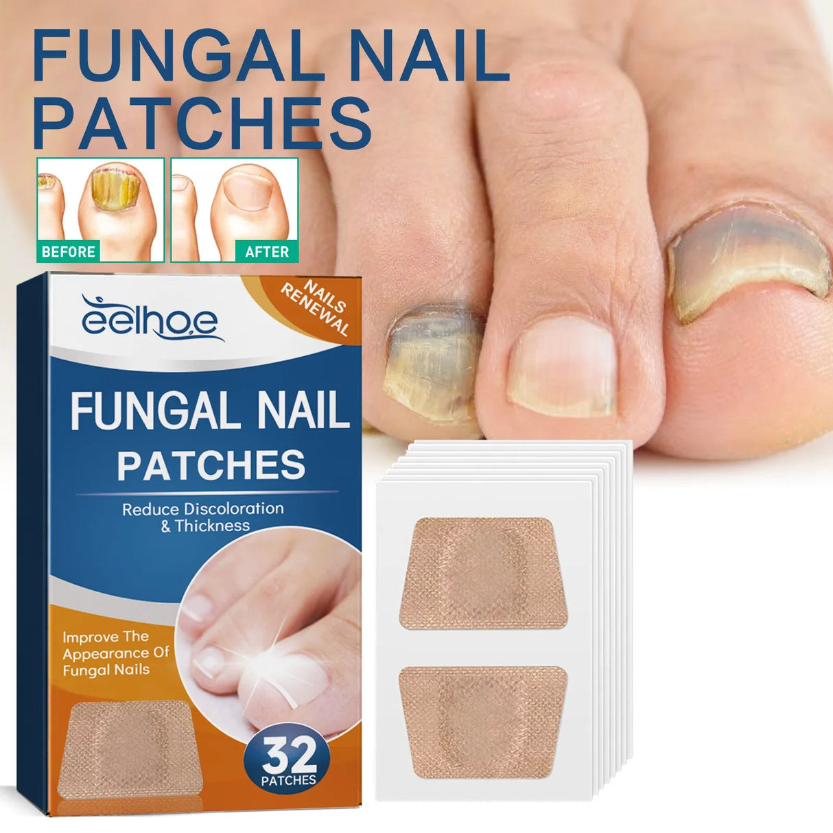 32/64PCS Paronychia Treatment Patch Fungus Removal Nail Ingrown Correction Stickers Nails Recover Pedicure Tools Health Care