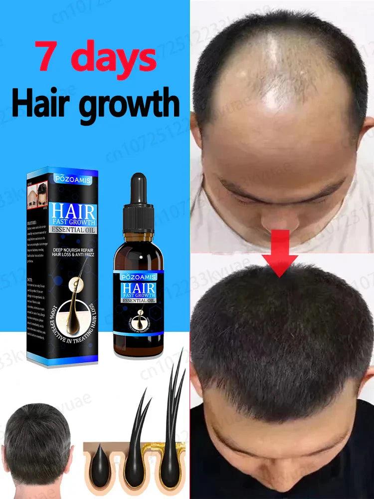 Hair growth essence can quickly grow hair and effectively repair baldness, alopecia areata, hereditary hair loss, postpartum hai