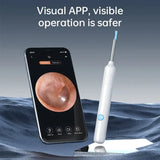 Visual Ear Cleaner with Camera Silicone Ear Spoon Otoscope 8MP Ear Wax Removal with 6 LEDS for Kids and Adults Ear Health Care