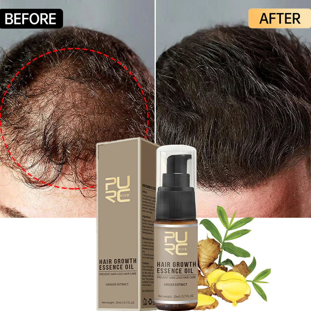 PURC Hair Growth Oil for Men Women Anti Hair Loss Scalp Treatment Serum Ginger 7 Day Fast Regrowth Care Hair Growth Products