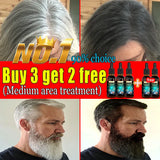 Gray Hair Killer - Seven Days to Solve the Problem of Gray Hair Natural Hair Color Repair Nourishing Essence for Men and Women