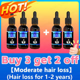 Hair growth essence can quickly grow hair and effectively repair baldness, alopecia areata, hereditary hair loss, postpartum hai