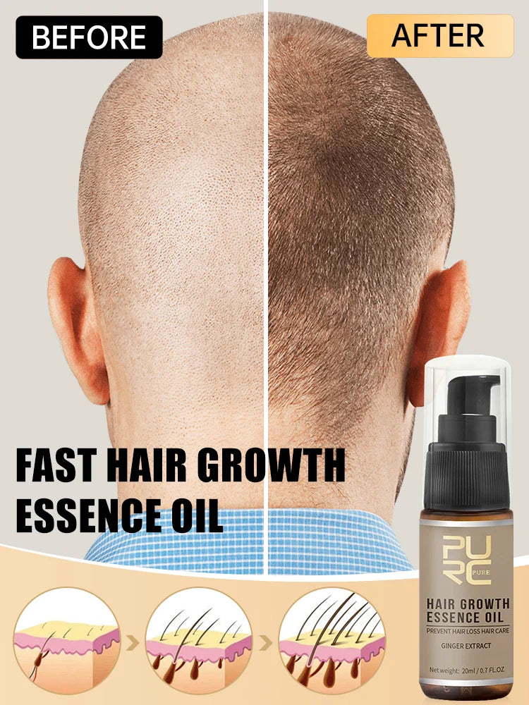 PURC Hair Growth Oil for Men Women Anti Hair Loss Scalp Treatment Serum Ginger 7 Day Fast Regrowth Care Hair Growth Products