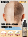 PURC Hair Growth Oil for Men Women Anti Hair Loss Scalp Treatment Serum Ginger 7 Day Fast Regrowth Care Hair Growth Products