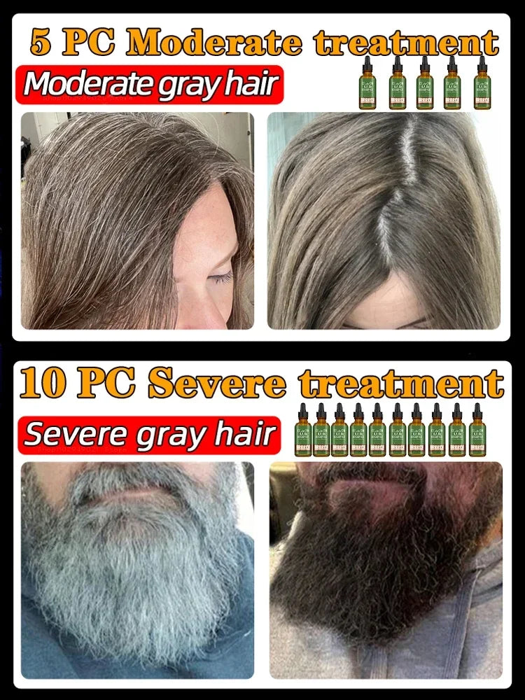 Gray Hair Treatment Serum White to Black Natural Color Repair Nourishing Products Anti-Hair Loss Care Men Women