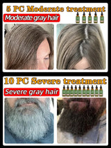 Gray Hair Treatment Serum White to Black Natural Color Repair Nourishing Products Anti-Hair Loss Care Men Women