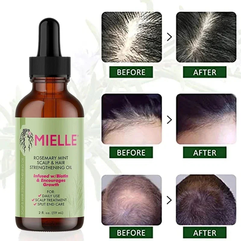 10pcs Organics Mielle Rosemary Mint Hair Growth Essential Oil Scalp & Hair Strengthen Oil Nourishing Improve Split Ends 59ml