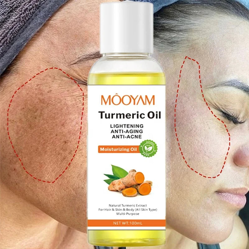 Turmeric Oil Face Whitening Lightening Acne Dark Patches Anti-aging Dark Spot Corrector Skin Care Turmeric Oil for Dark Skin