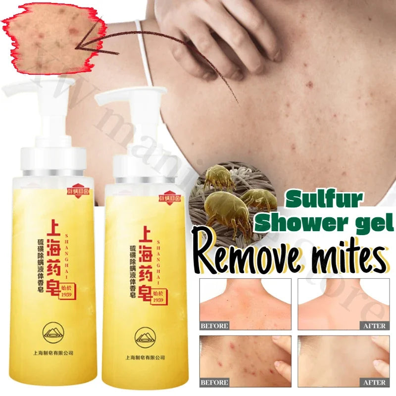 Sulfur Mite Remover Shower Gel Deep Cleansing Body Acne Removal Oil Moisturizing Exfoliating Body Care Shower Gel  Body Wash