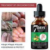 7DAYS Repair Nail Fungus Treatments Essence Foot Care Serum Toe Nails Fungal Removal Gel Anti-Infection Onychomycosis Care Tool