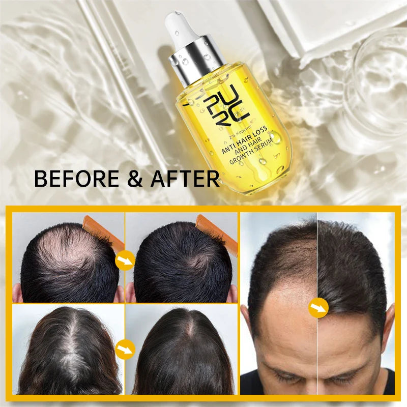 Fast Hair Growth for Men Women Ginger Grow Hair Oil Care Anti Hair Loss Scalp Treatment Serum Products Beauty Health 2023