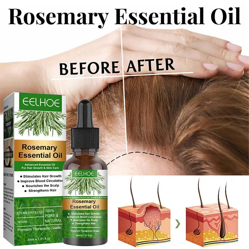 Rosemary Oil for Hair Growth Anti Hairs Loss Hair Oil for Fast Hair Growth Oil for Black Women Hair Care Treatment Essential Oil