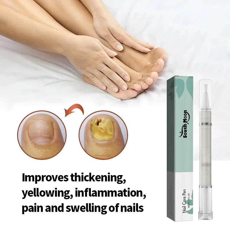 Nail Treatment Pen Anti Fungal Nail Ingrown Cream Paronychia Repair Anti Fungus Infection Cleaner Toenail Care Correction Tool