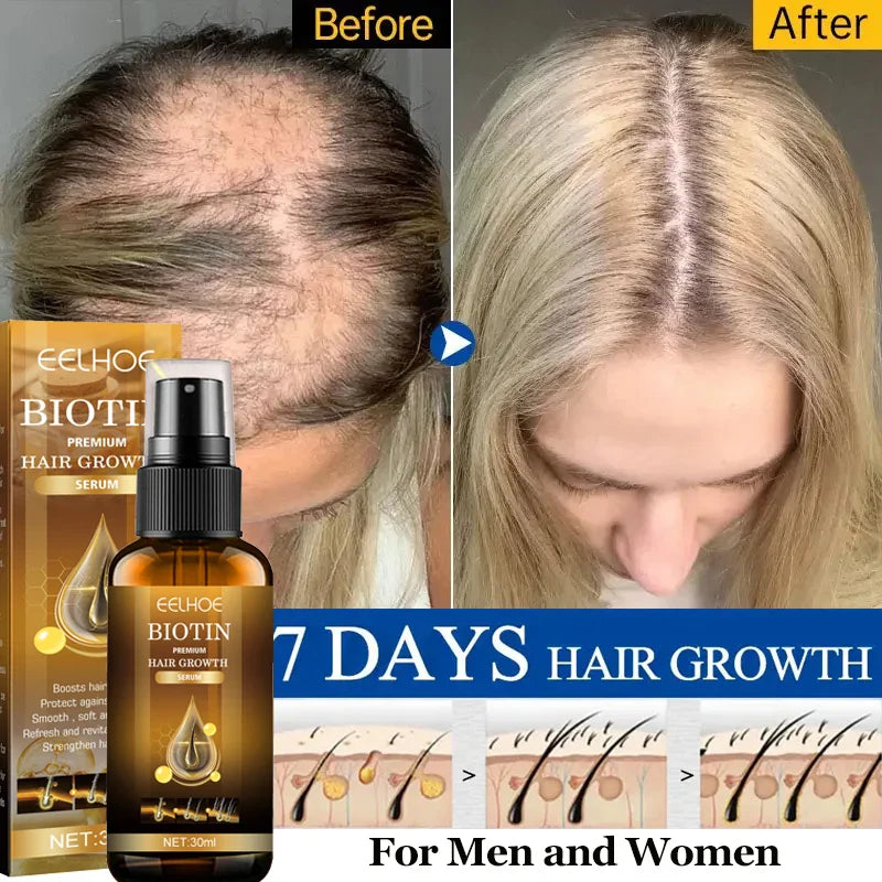 Biotin Fast Hair Growth Products Anti Hair Loss Serum Spray Prevent Baldness Treatment Scalp Beard Beauty Hair Care Men Women