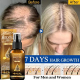 Biotin Fast Hair Growth Products Anti Hair Loss Serum Spray Prevent Baldness Treatment Scalp Beard Beauty Hair Care Men Women