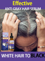 Natural Anti Gray Hair Serum - Repair White & Darkening Hair | Nourishing Hair Care Remedy