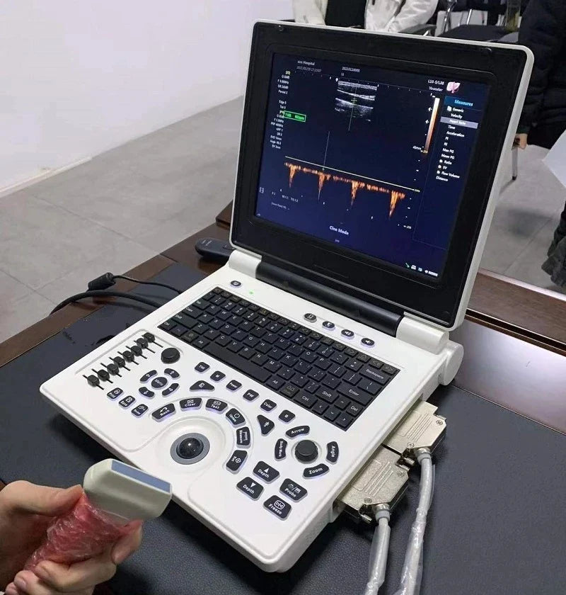 3D Based 12 Inch Notebook Black White Ultrasound Scanner PW Echo Machine