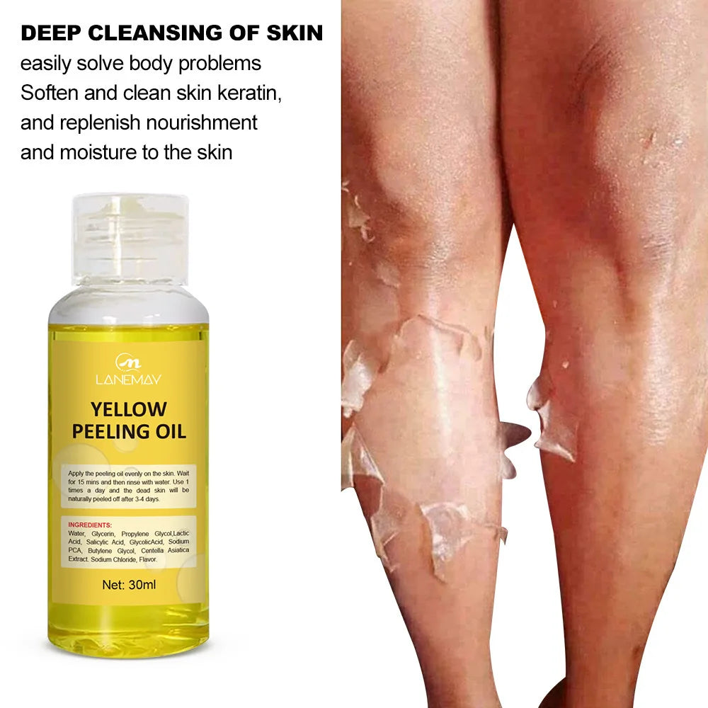 Yellow Peeling Oil Dark Skin Bleaching Remove Arm Knee Legs Melanin Body Brighten Scrub Exfoliating Dead Skin Care Whiten Serum