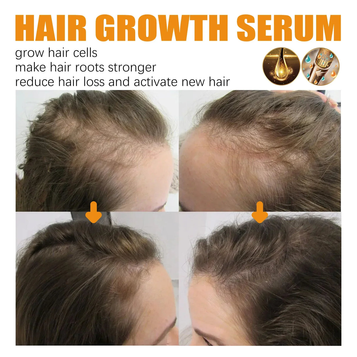 Biotin Fast Hair Growth Products Anti Hair Loss Serum Spray Prevent Baldness Treatment Scalp Beard Beauty Hair Care Men Women