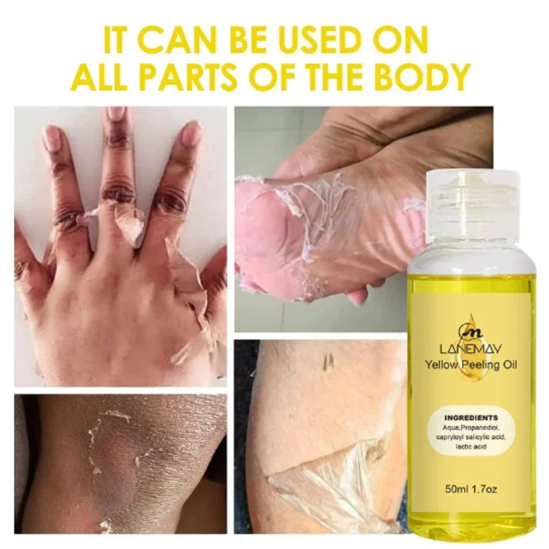 Yellow Peeling Oil Dark Skin Bleaching Remove Arm Knee Legs Melanin Body Brighten Scrub Exfoliating Dead Skin Care Whiten Serum