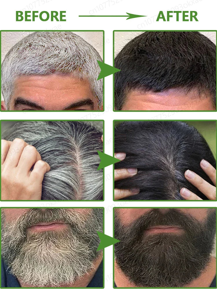 Gray Hair Killer - Seven Days to Solve the Problem of Gray Hair Natural Hair Color Repair Nourishing Essence for Men and Women