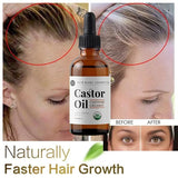 Castor Oil Prevents Hair Loss Stimulate Eyelashes Eyebrows Hair Growth Moisturize Skin Care Hair Growth Products Beauty Health