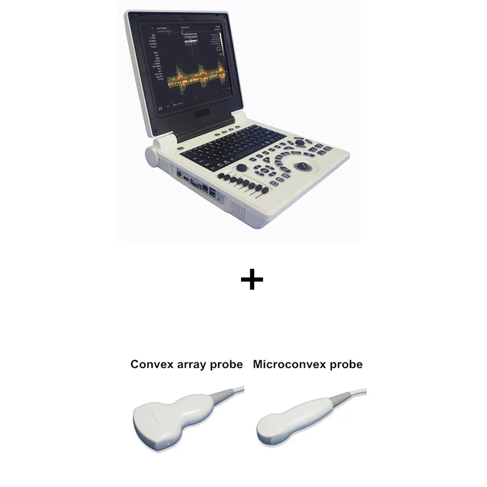 3D Based 12 Inch Notebook Black White Ultrasound Scanner PW Echo Machine