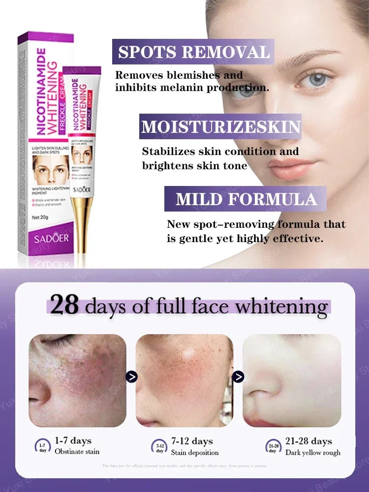 Whitening Freckle Cream Dark Spot Remover Deep Melasma  Age Sun Spots