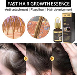 Fast Hair Growth Hair Follicle Treatment Hair Growth Seborrheic Alopecia Hairline Upward Postpartum Hair Loss Baldness Hair Loss