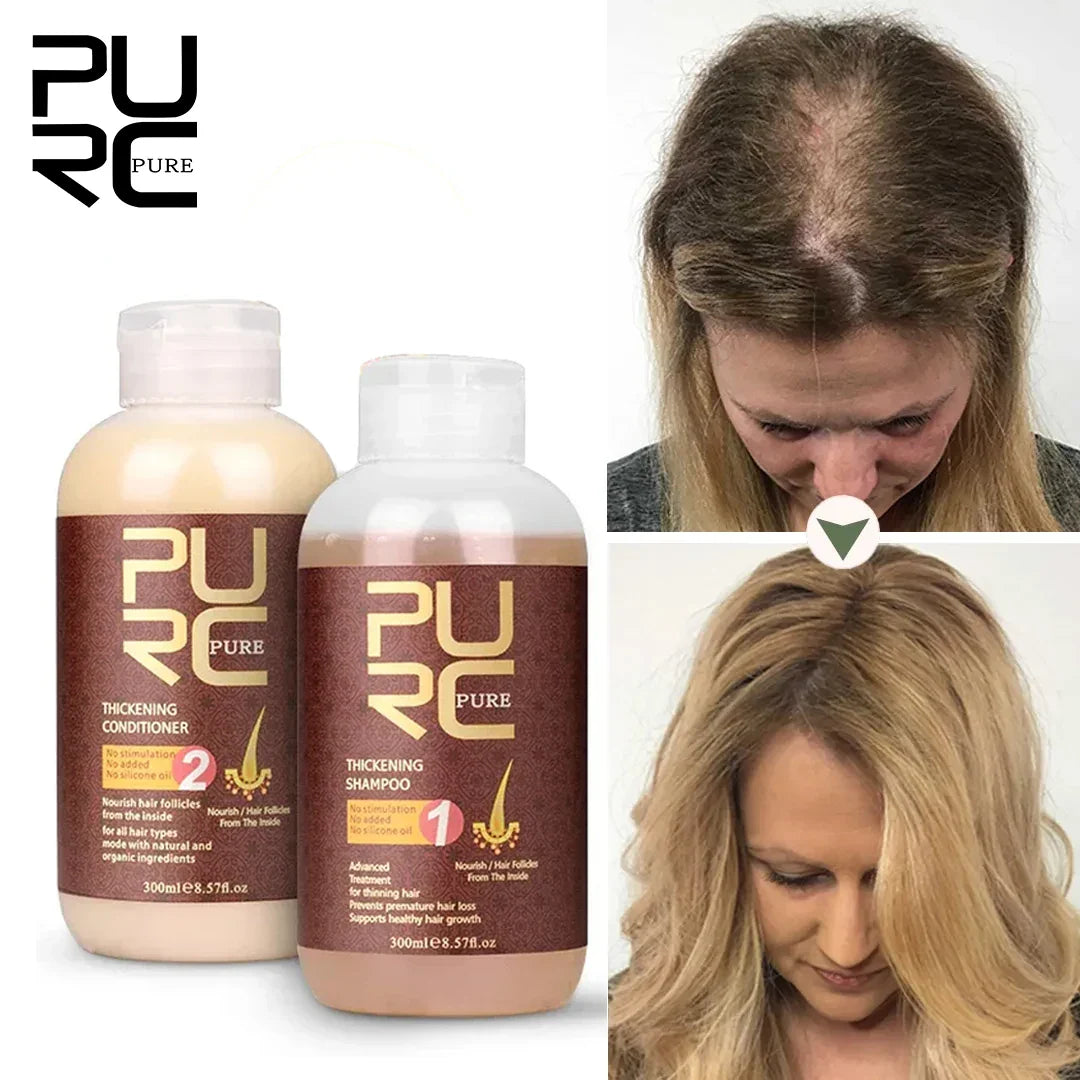 PURC 300ML Ginger Shampoo Set Anti Hair Loss Fast Regrowth Repair Damaged Smoothing Treatment Shampoo Conditioner Hair Care