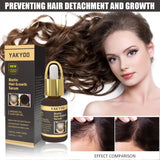 Fast Hair Growth Hair Follicle Treatment Hair Growth Seborrheic Alopecia Hairline Upward Postpartum Hair Loss Baldness Hair Loss