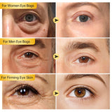 2/3/5/10 PCS Eye Cream Eye Bags Removal Under The Eye Skin Care Moisturizing Anti Aging Wrinkle Women Men Face Care Beauty