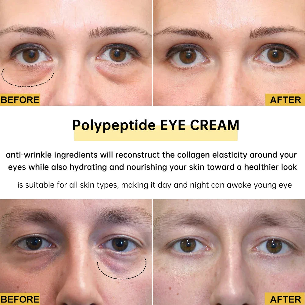 2/3/5/10 PCS Eye Cream Eye Bags Removal Under The Eye Skin Care Moisturizing Anti Aging Wrinkle Women Men Face Care Beauty