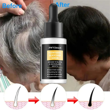 Gray White Hair Treatment Serum Oil White To Black Permanent Treatment Natural Color Repair Anti Loss Product Care For Men Women