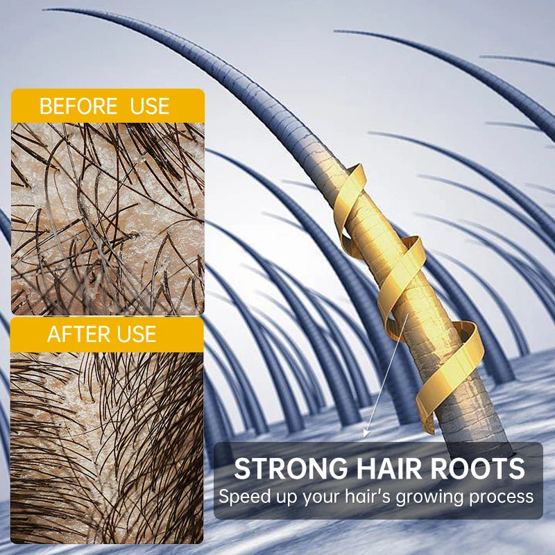 Fast Hair Growth for Men Women Ginger Grow Hair Oil Care Anti Hair Loss Scalp Treatment Serum Products Beauty Health 2023