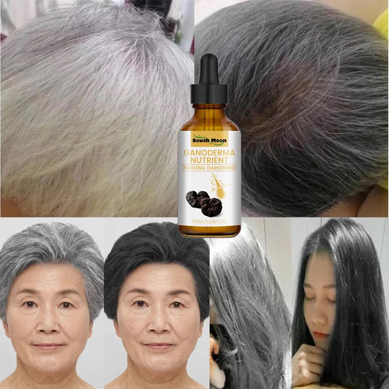 Gray White Hair Treatment Serum White To Black Repair Natural Color Black Rice Nourish Spray Anti Loss Hair High Quality Product