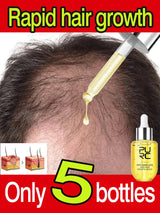 Fast Hair Growth for Men Women Ginger Grow Hair Oil Care Anti Hair Loss Scalp Treatment Serum Products Beauty Health 2023