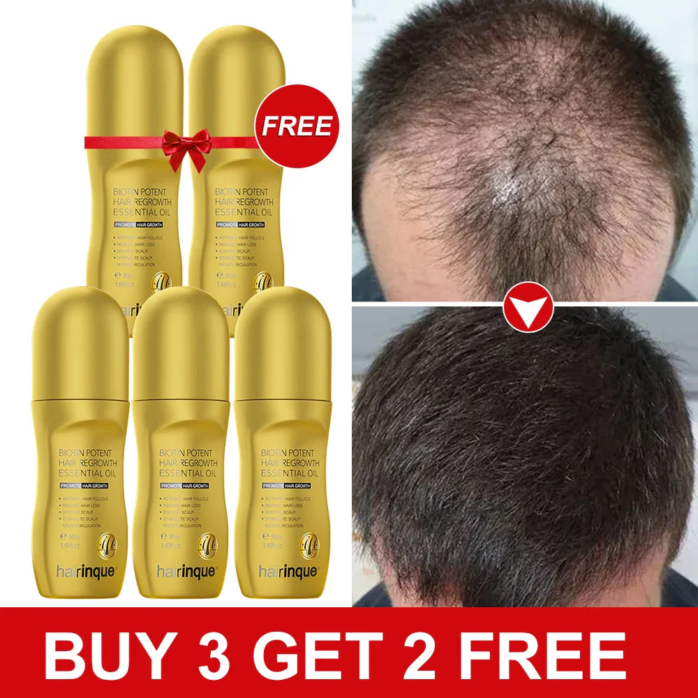 Hairinque Biotin Hair Growth for Men Women Set Vitamin Hair Regrowth Thicken Preventive Baldness Hair Care Oil Beauty Health