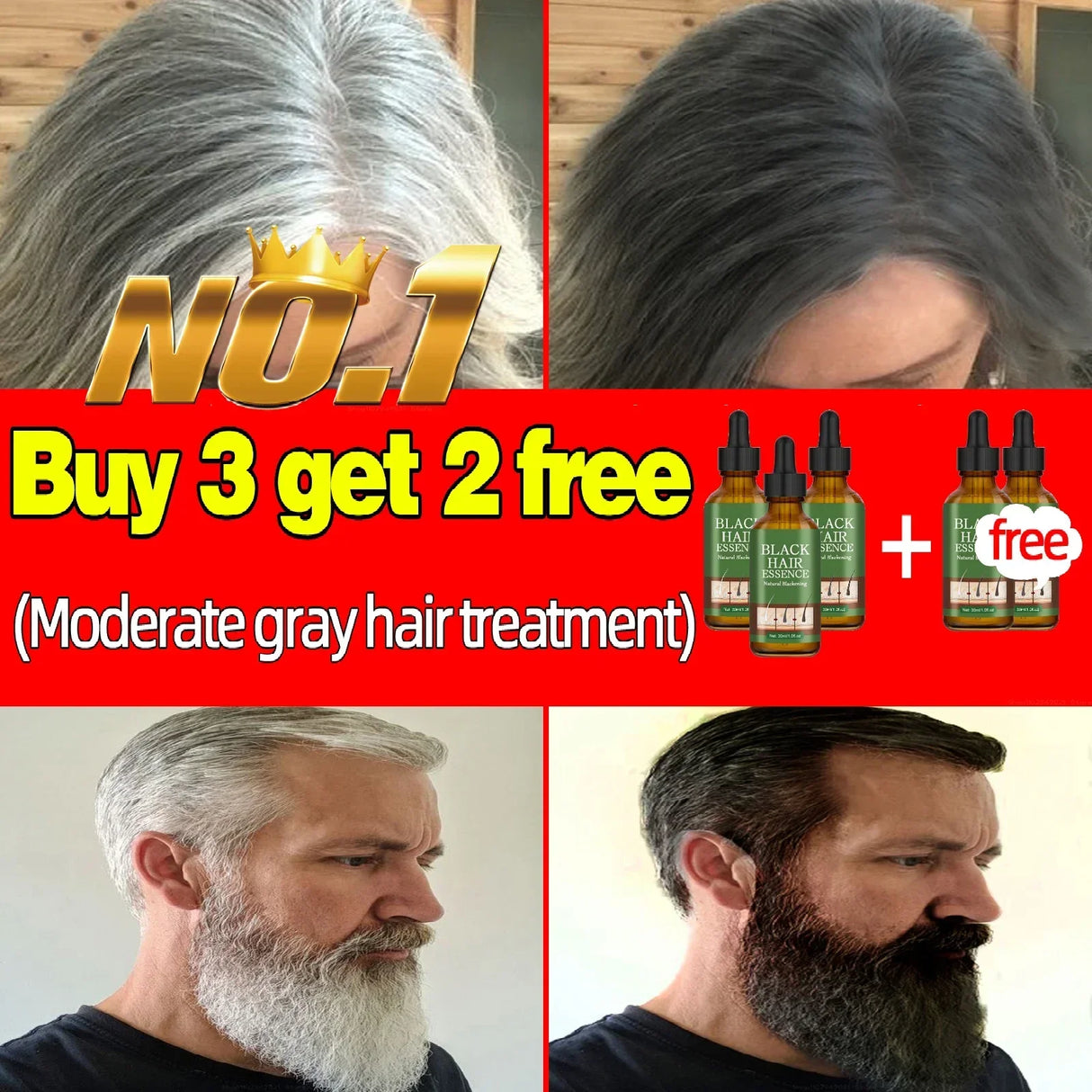 Gray Hair Treatment Serum White to Black Natural Color Repair Nourishing Products Anti-Hair Loss Care Men Women