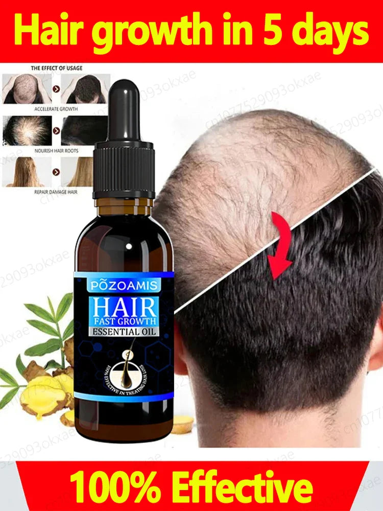 Hair growth essence can quickly grow hair and effectively repair baldness, alopecia areata, hereditary hair loss, postpartum hai