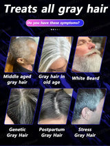 Gray Hair Killer - Seven Days to Solve the Problem of Gray Hair Natural Hair Color Repair Nourishing Essence for Men and Women