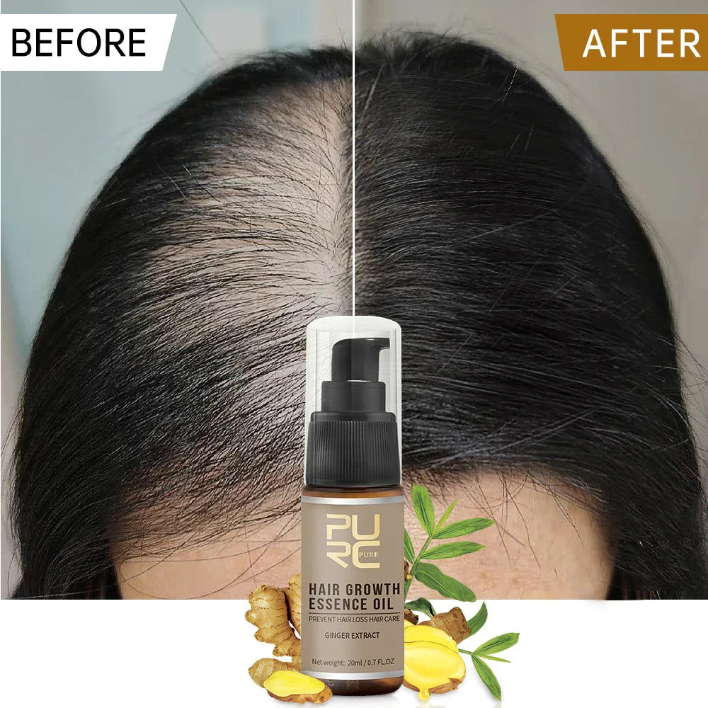 PURC Hair Growth Oil for Men Women Anti Hair Loss Scalp Treatment Serum Ginger 7 Day Fast Regrowth Care Hair Growth Products