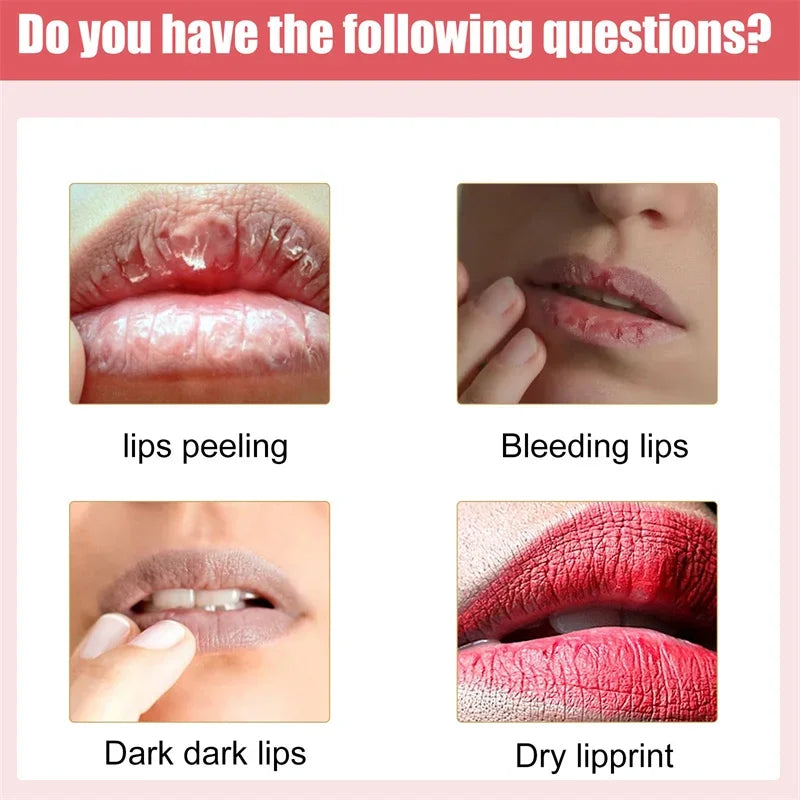 Lips Pink Fresh Whitening Lip Balm Dark Lip Treatment Repair Sexy Pink Lip Essence Moisturize Bleaching Dilute Melanin Lip Care