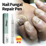 Nail Treatment Pen Anti Fungal Nail Ingrown Cream Paronychia Repair Anti Fungus Infection Cleaner Toenail Care Correction Tool