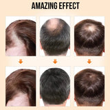 PURC Hair Growth Products for Men Women Ginger Anti Hair Loss Care Oil Fast Regrowth Thicken Scalp Treatment Hair Care