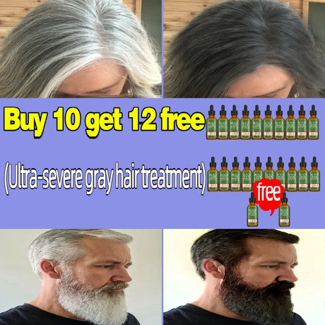 Gray Hair Treatment Serum White to Black Natural Color Repair Nourishing Products Anti-Hair Loss Care Men Women