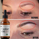 Castor Oil Prevents Hair Loss Stimulate Eyelashes Eyebrows Hair Growth Moisturize Skin Care Hair Growth Products Beauty Health