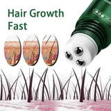 Hair Growth Oil Fast Hair Growth Effective Baldness Repair Hereditary Postpartum Hair Loss Seborrheic